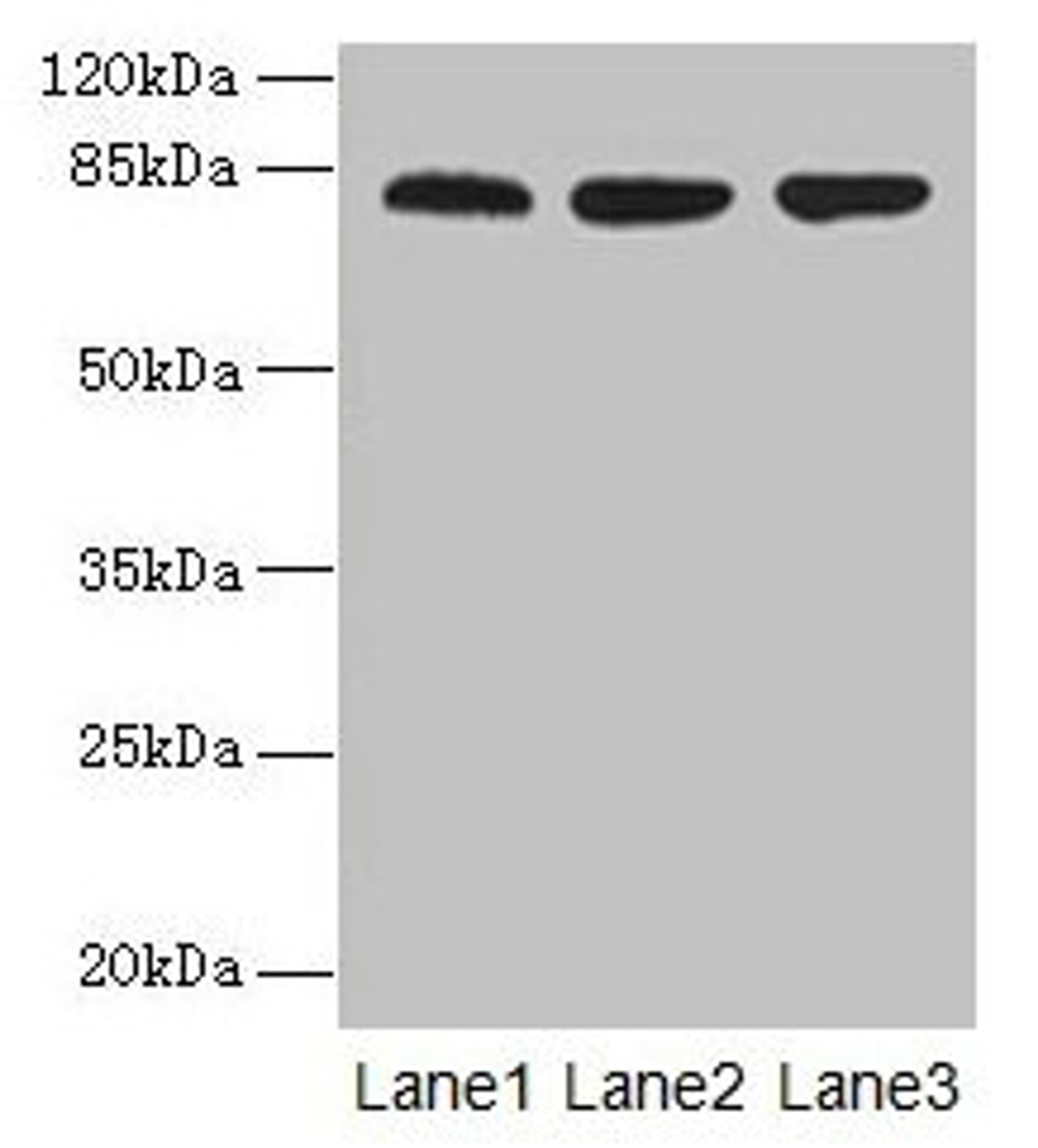 Western blot. All lanes: ACAP1 antibody at 4µg/ml. Lane 1: Mouse lung tissue. Lane 2: Jurkat whole cell lysate. Lane 3: K562 whole cell lysate. Secondary. Goat polyclonal to rabbit IgG at 1/10000 dilution. Predicted band size: 82 kDa. Observed band size: 82 kDa