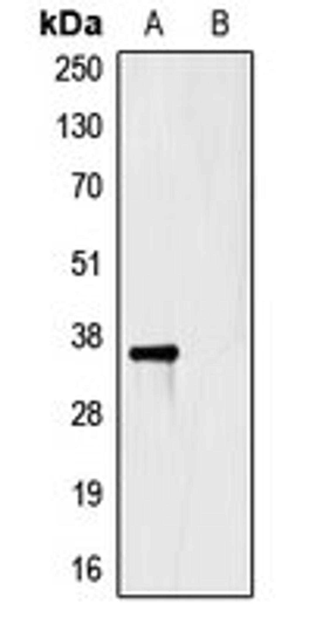 Western blot analysis of HEK293T cells using HSV-tag antibody