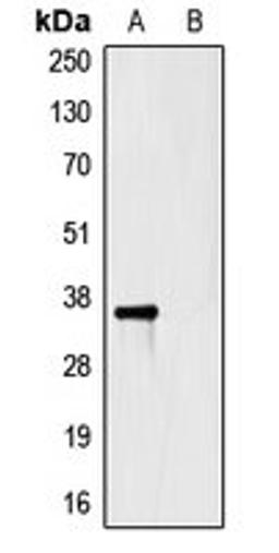 Western blot analysis of HEK293T cells using HSV-tag antibody