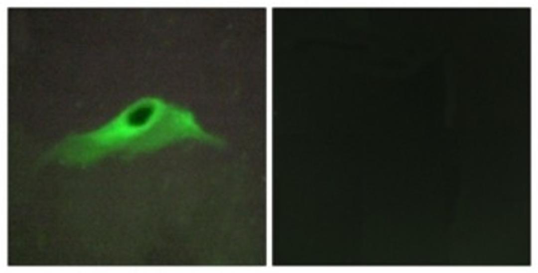 Immunocytochemistry/Immunofluorescence: Collagen IV alpha5 Antibody [NBP1-71565] - Analysis of HeLa cells, using Collagen IV alpha5 Antibody. The picture on the right is treated with the synthesized peptide.