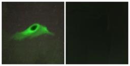 Immunocytochemistry/Immunofluorescence: Collagen IV alpha5 Antibody [NBP1-71565] - Analysis of HeLa cells, using Collagen IV alpha5 Antibody. The picture on the right is treated with the synthesized peptide.