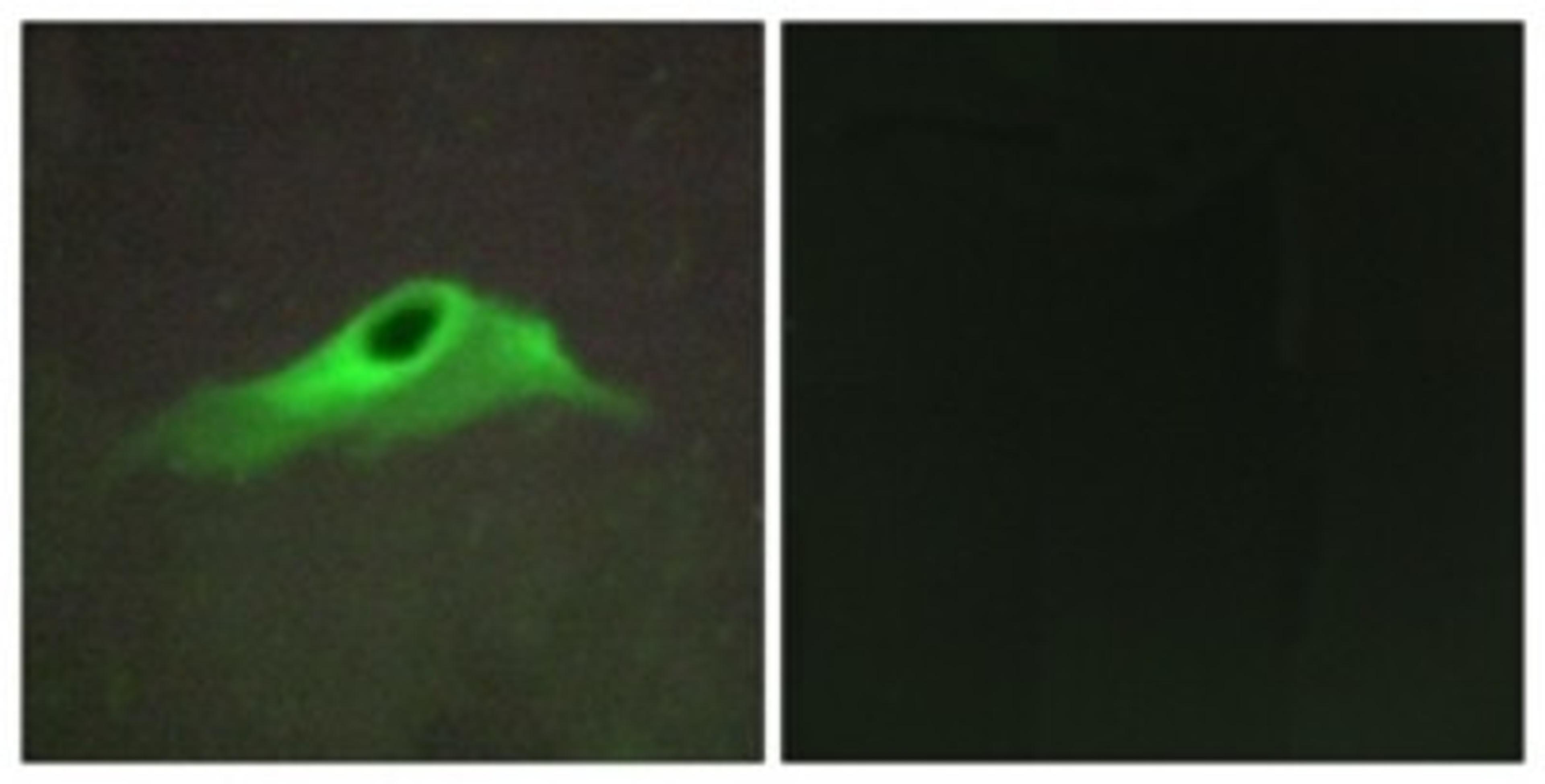 Immunocytochemistry/Immunofluorescence: Collagen IV alpha5 Antibody [NBP1-71565] - Analysis of HeLa cells, using Collagen IV alpha5 Antibody. The picture on the right is treated with the synthesized peptide.