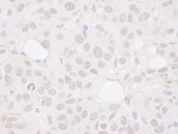 Detection of human Symplekin by immunohistochemistry.