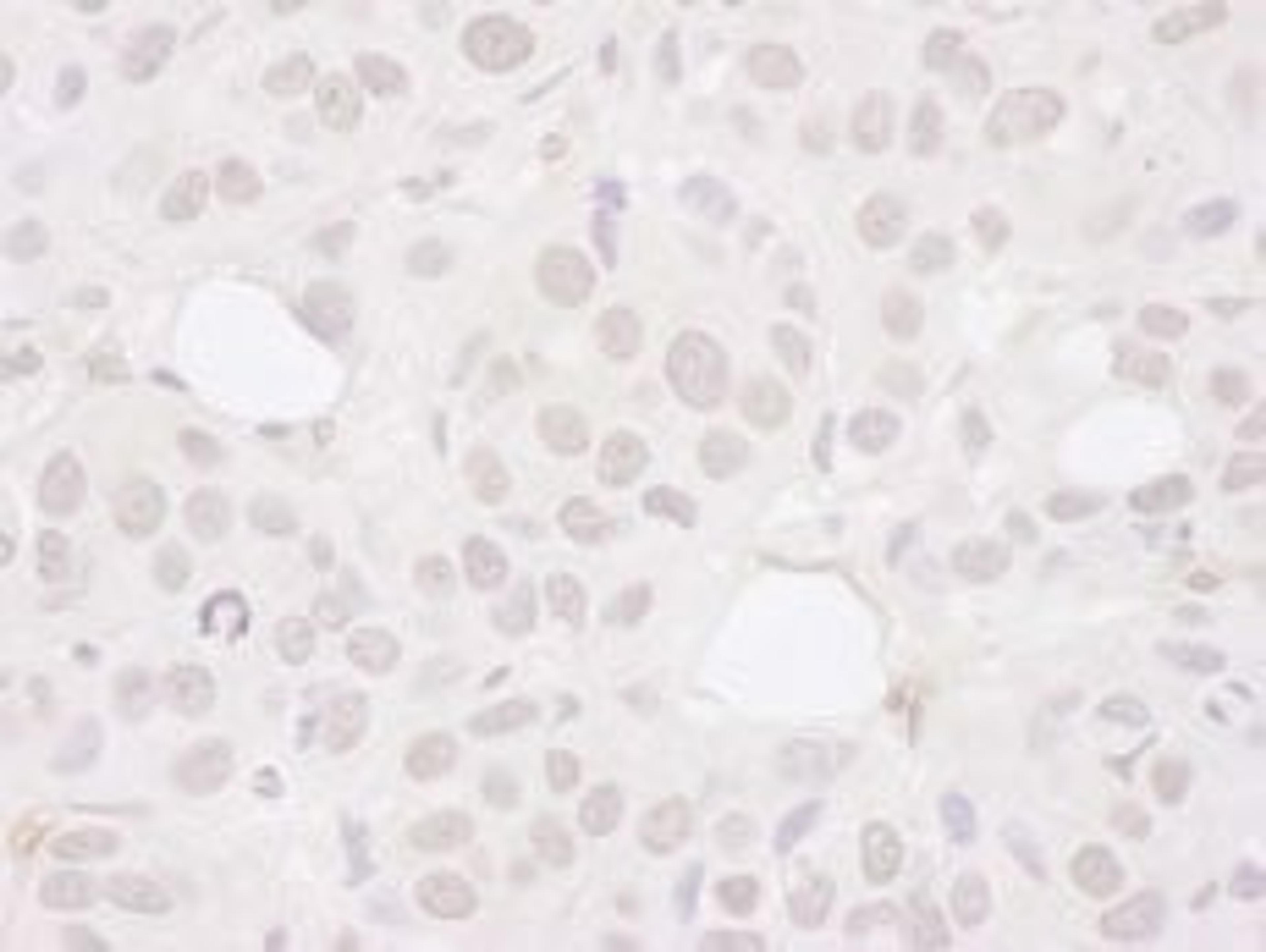 Detection of human Symplekin by immunohistochemistry.