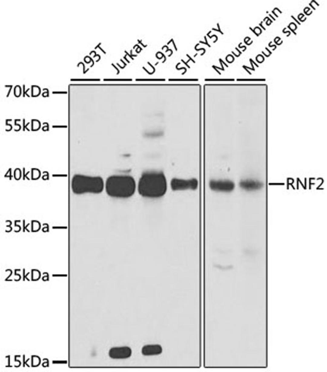 Western blot - RNF2 antibody (A5563)