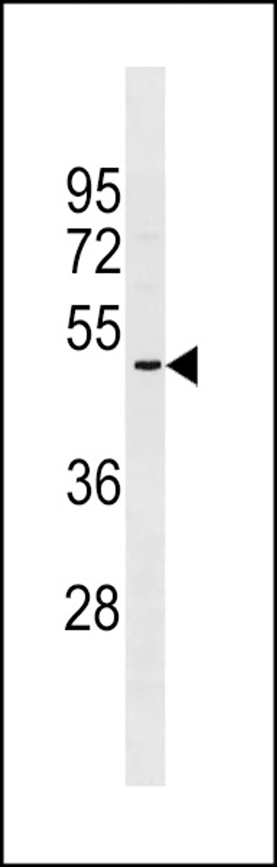 Western blot analysis in NCI-H460 cell line lysates (35ug/lane).