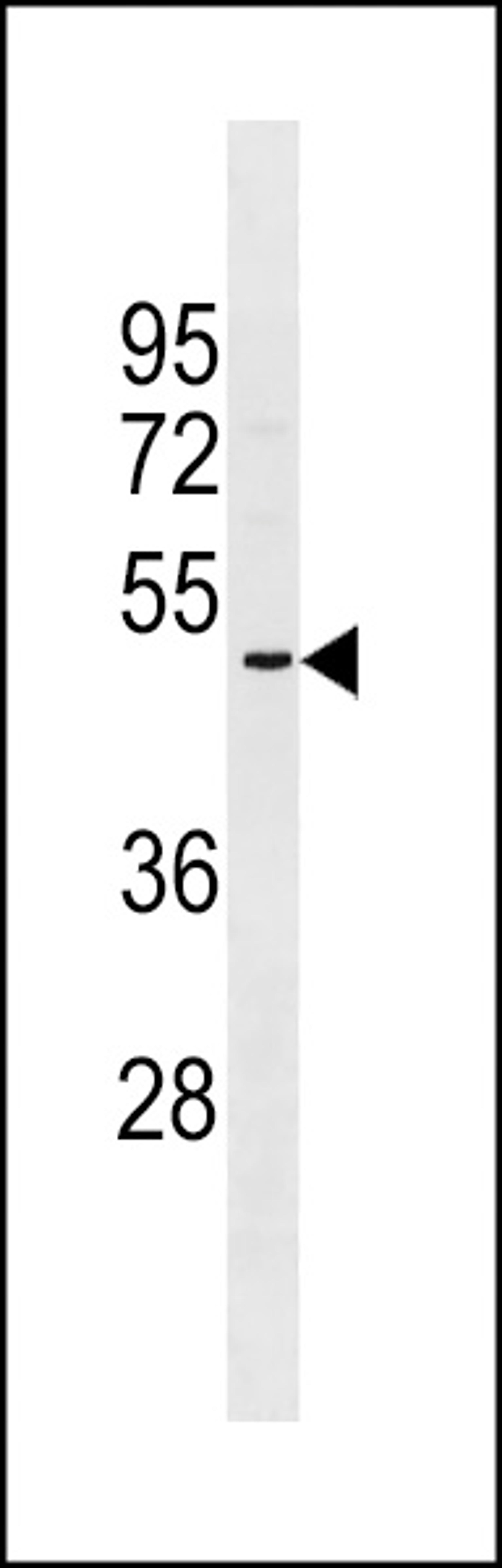 Western blot analysis in NCI-H460 cell line lysates (35ug/lane).