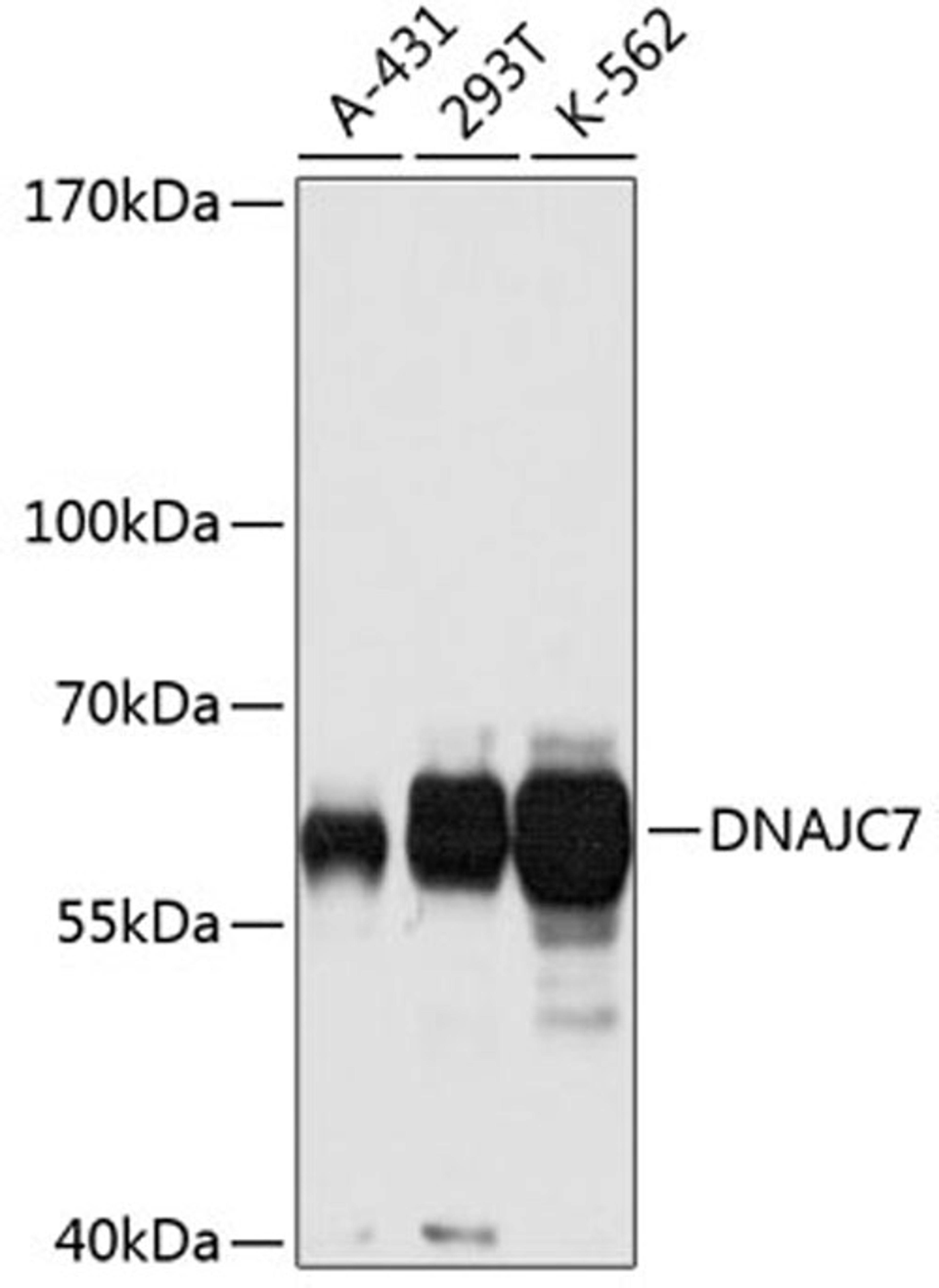 Western blot - DNAJC7 antibody (A2780)