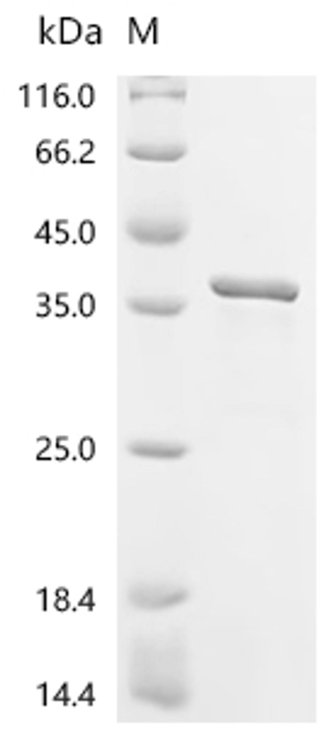 (Tris-Glycine gel) Discontinuous SDS-PAGE (reduced) with 5% enrichment gel and 15% separation gel.