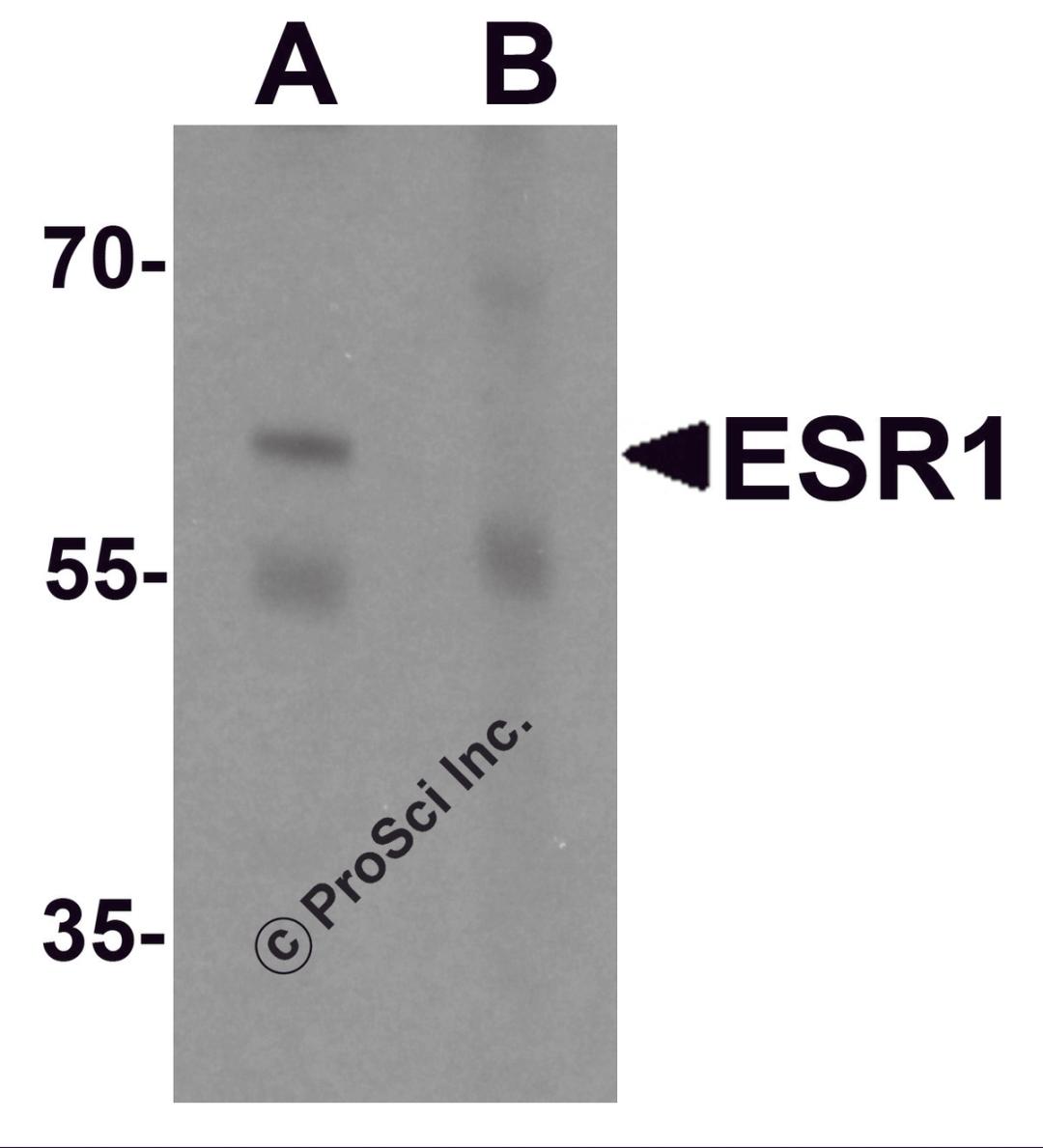 Western blot analysis of ESR1 in rat brain tissue lysate with ESR1 antibody at 1 μg/mL in (A) the absence and (B) the presence of blocking peptide.