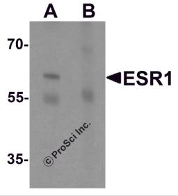 Western blot analysis of ESR1 in rat brain tissue lysate with ESR1 antibody at 1 μg/mL in (A) the absence and (B) the presence of blocking peptide.