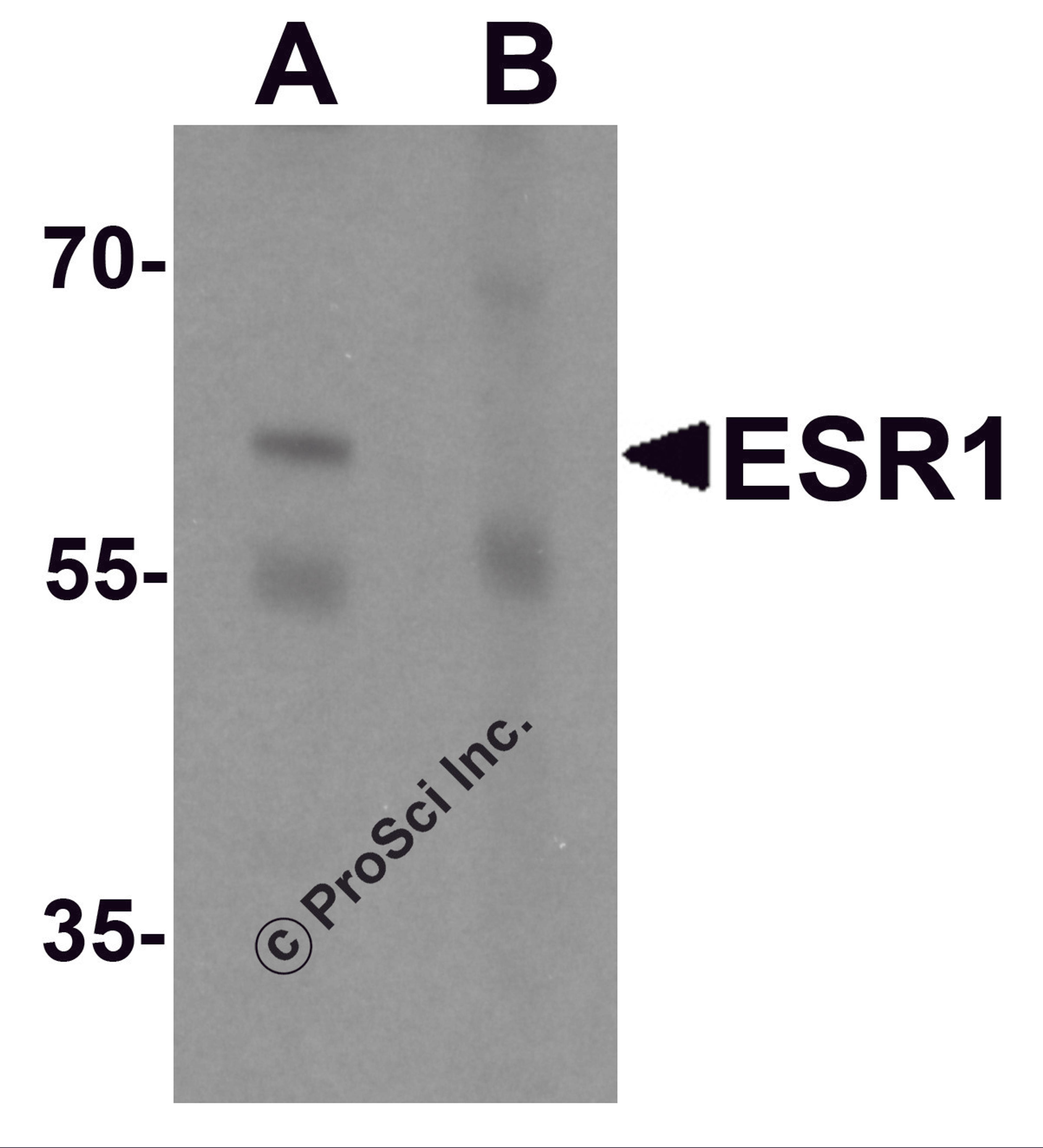 Western blot analysis of ESR1 in rat brain tissue lysate with ESR1 antibody at 1 μg/mL in (A) the absence and (B) the presence of blocking peptide.