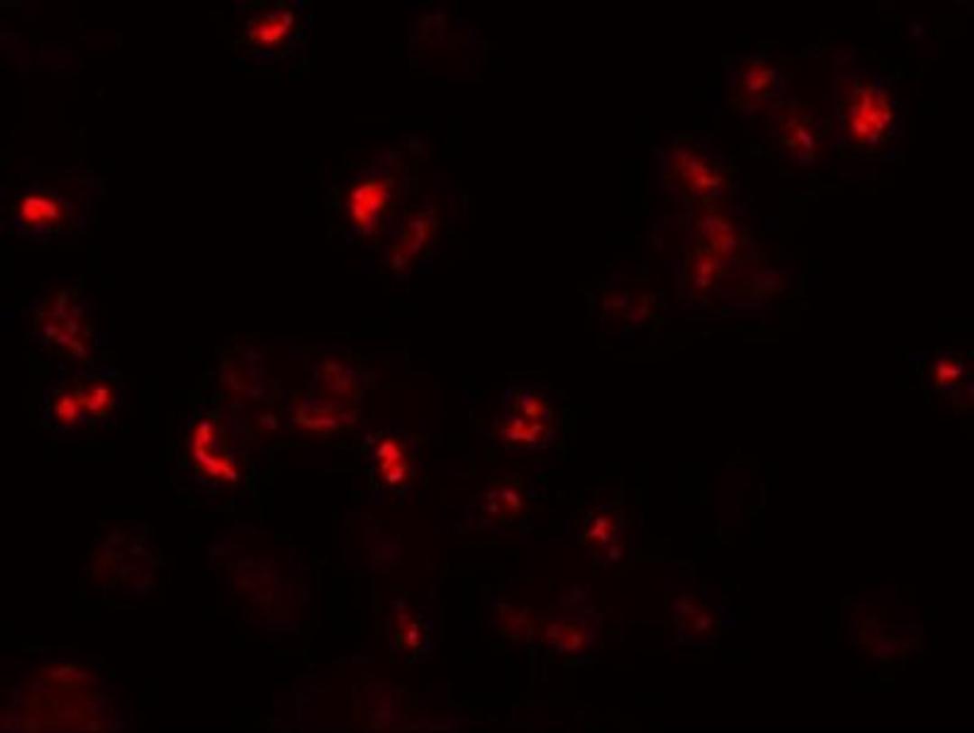 Immunocytochemistry/Immunofluorescence: CD229/SLAMF3/Lymphocyte Antigen 9 Antibody [NBP1-76557] - Immunofluorescence of Lymphocyte Antigen 9 in 293 cells with Lymphocyte Antigen 9 antibody at 20 ug/mL.