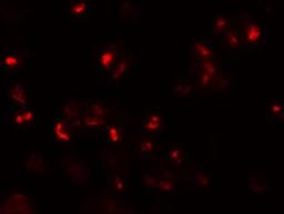 Immunocytochemistry/Immunofluorescence: CD229/SLAMF3/Lymphocyte Antigen 9 Antibody [NBP1-76557] - Immunofluorescence of Lymphocyte Antigen 9 in 293 cells with Lymphocyte Antigen 9 antibody at 20 ug/mL.