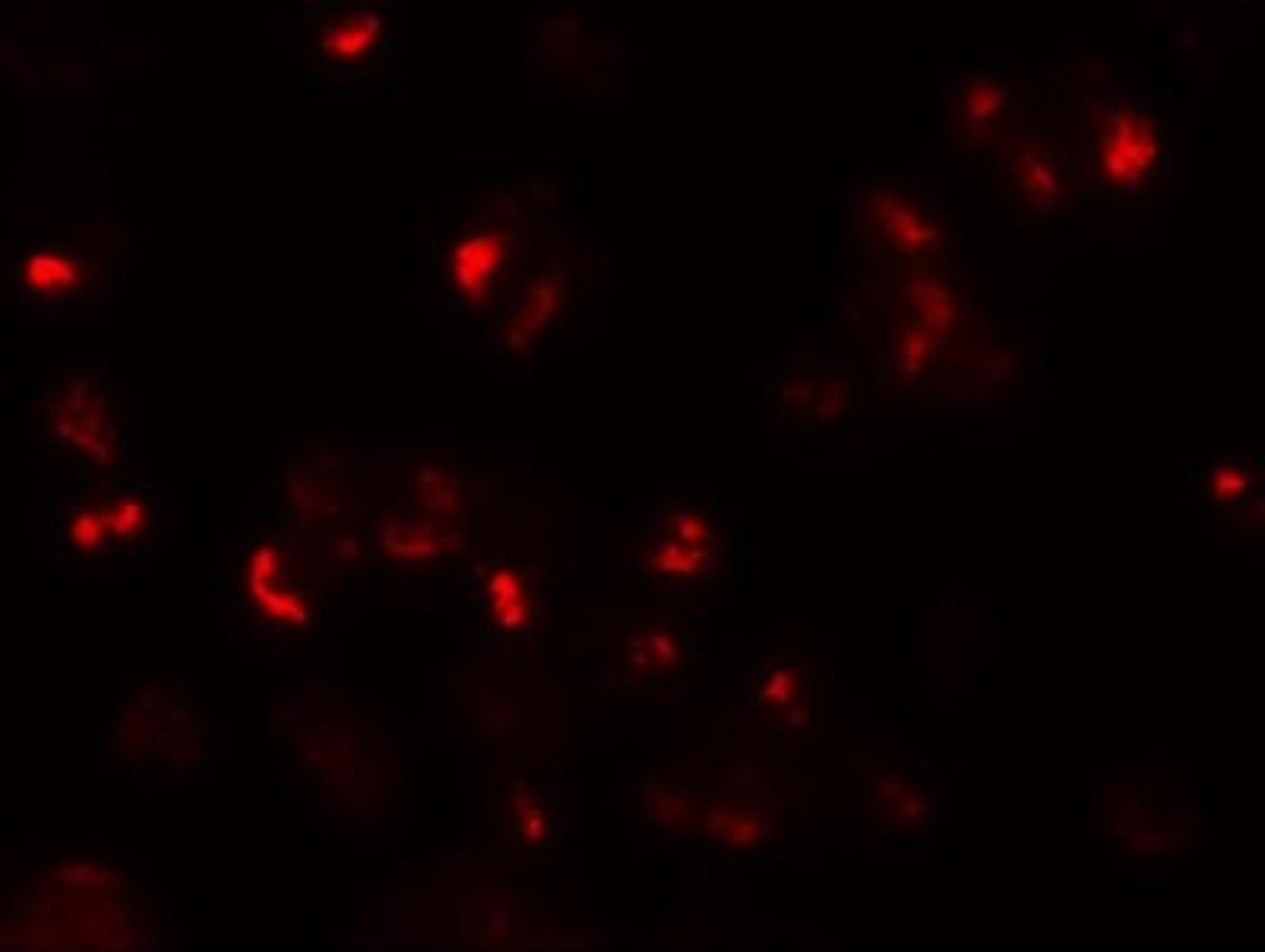 Immunocytochemistry/Immunofluorescence: CD229/SLAMF3/Lymphocyte Antigen 9 Antibody [NBP1-76557] - Immunofluorescence of Lymphocyte Antigen 9 in 293 cells with Lymphocyte Antigen 9 antibody at 20 ug/mL.