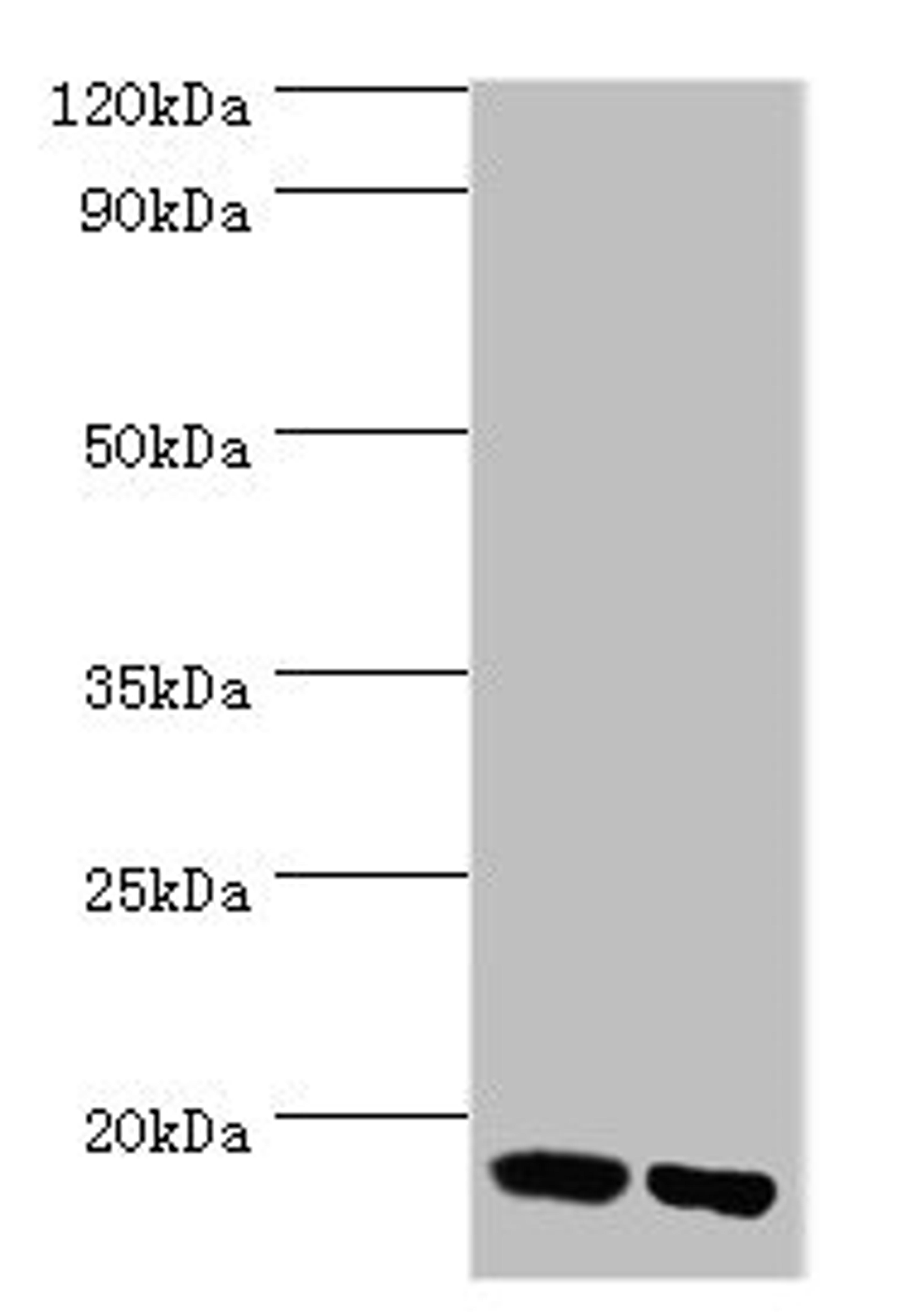Western blot. All lanes: Peptidyl-prolyl cis-trans isomerase FKBP2 antibody at 10ug/ml. Lane 1: Mouse thymus tissue. Lane 2: Rat brain tissue. Secondary. Goat polyclonal to rabbit IgG at 1/10000 dilution. Predicted band size: 16 kDa. Observed band size: 16 kDa. 