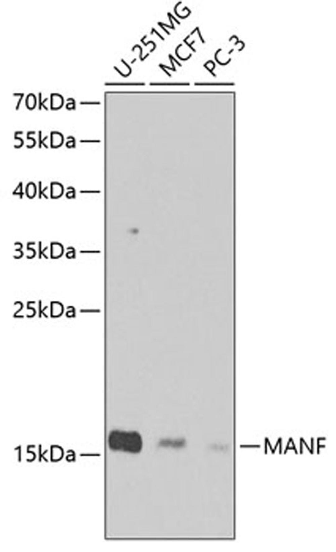 Western blot - MANF Antibody (A7005)