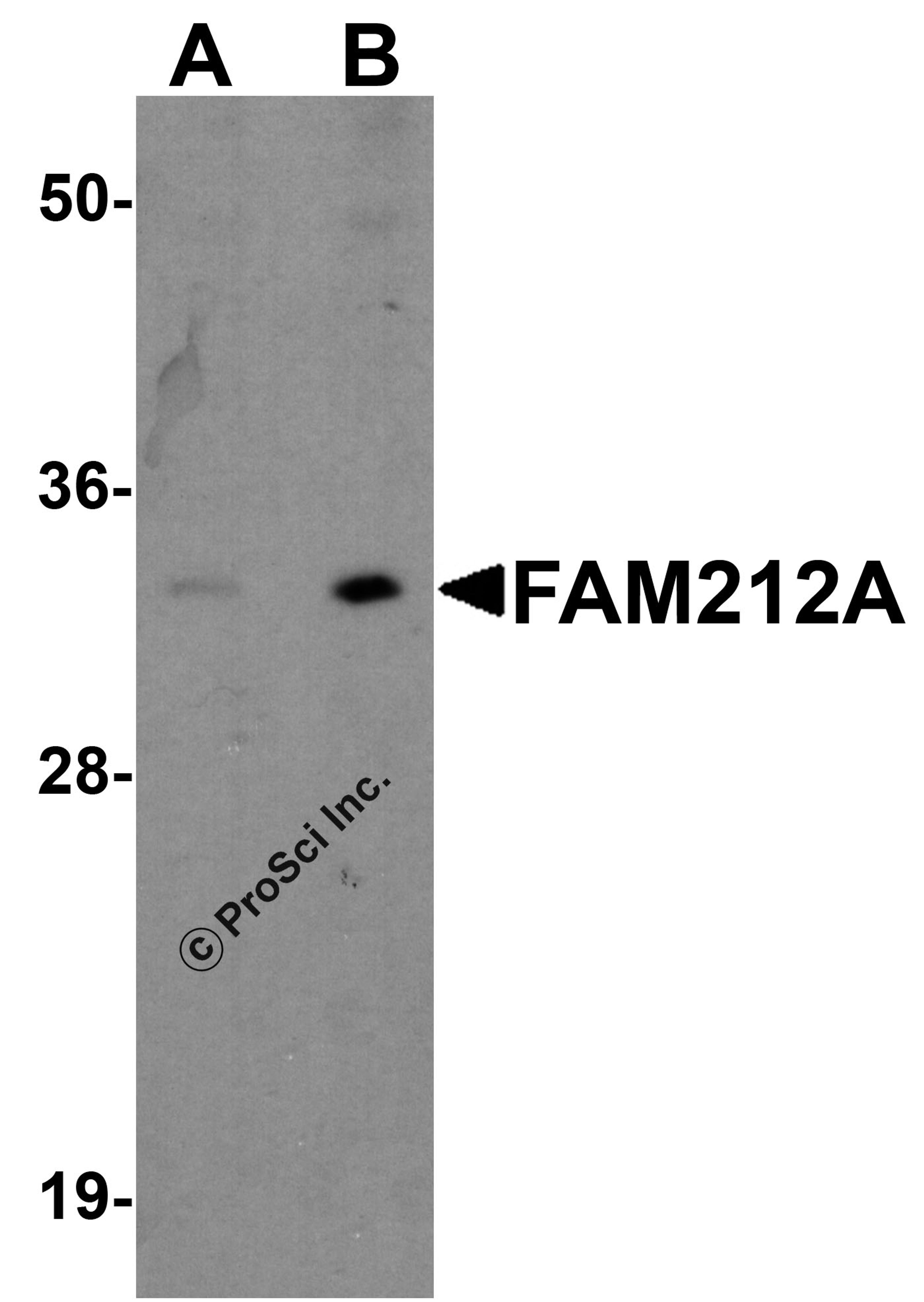 Western blot analysis of FAM212A in EL4 cell lysate with FAM212A antibody at (A) 1 and (B) 2 &#956;g/ml.