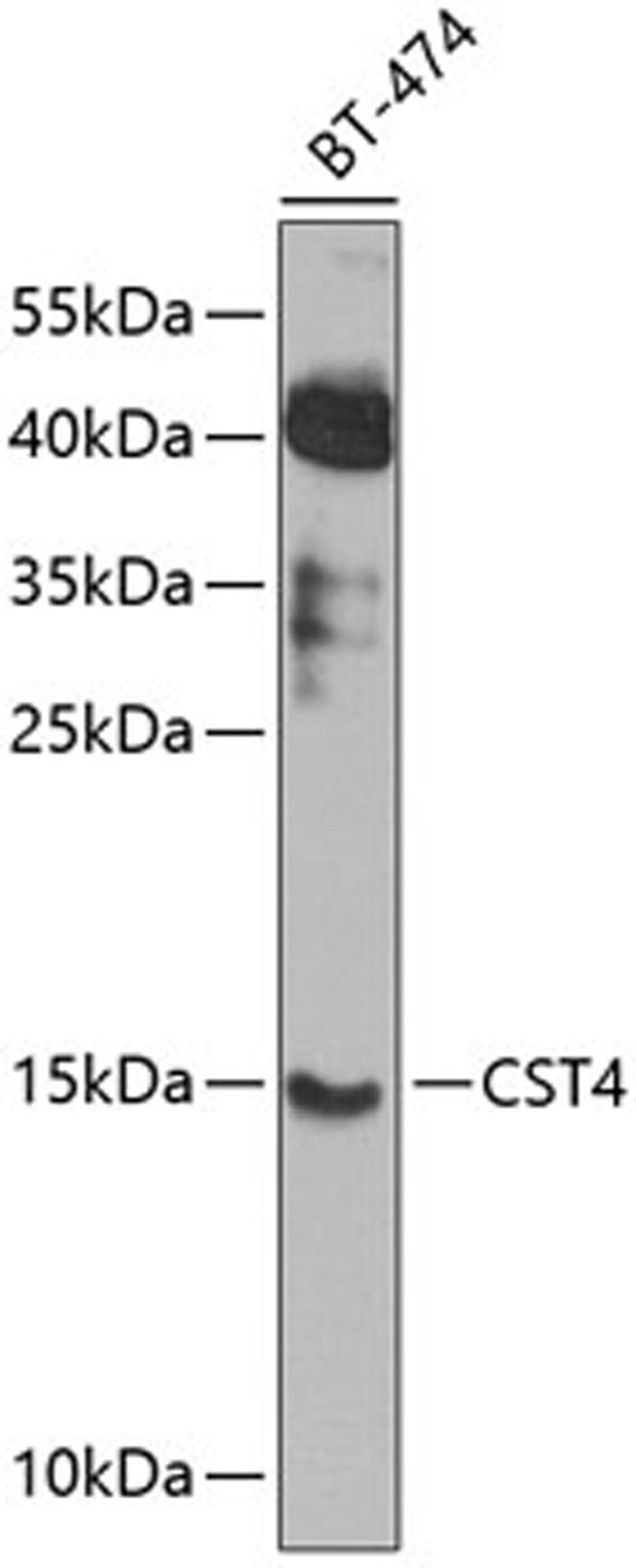 Western blot - CST4 antibody (A8114)