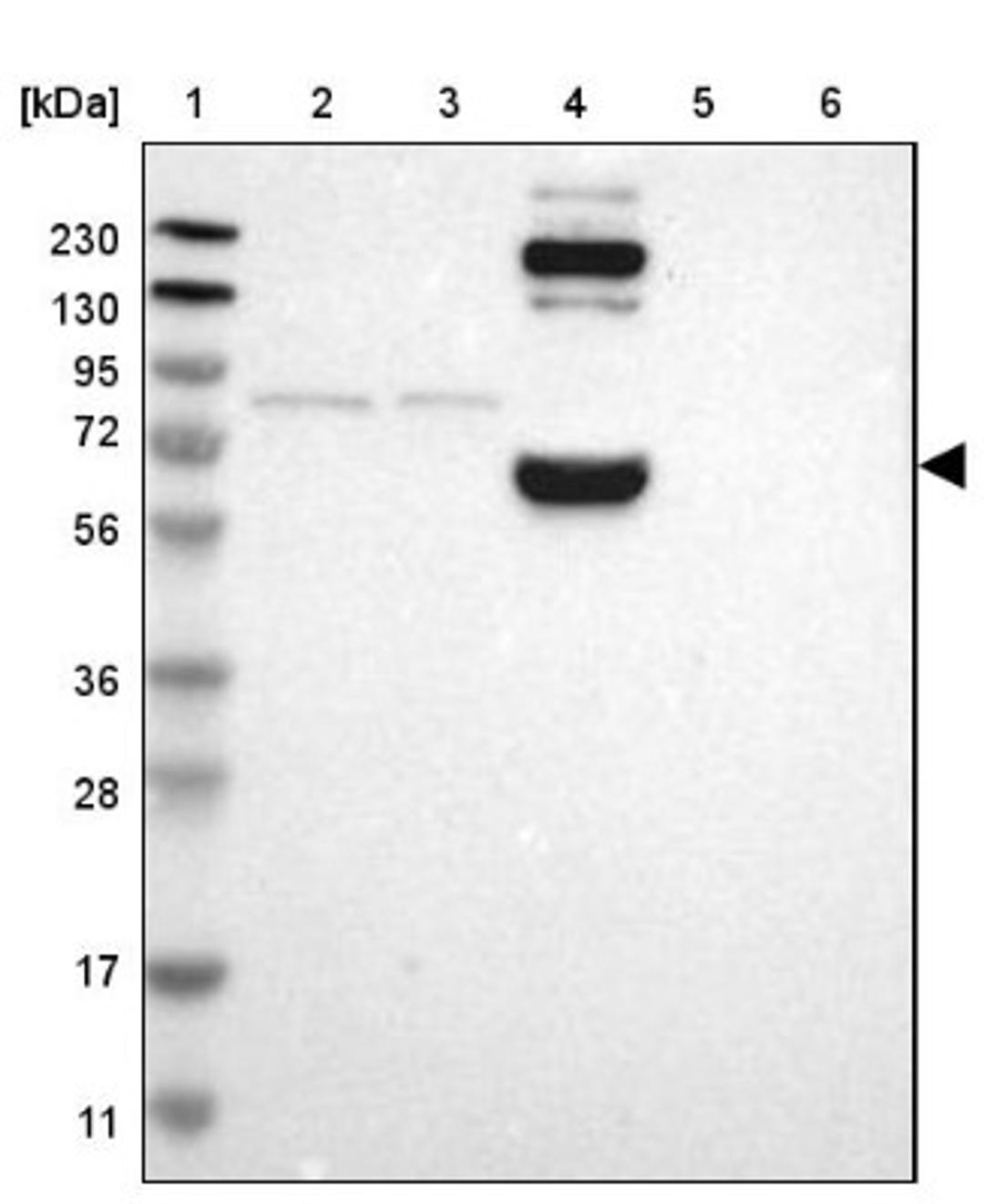 Western Blot: CNDP1 Antibody [NBP1-85528] - Lane 1: Marker [kDa] 230, 130, 95, 72, 56, 36, 28, 17, 11<br/>Lane 2: Human cell line RT-4<br/>Lane 3: Human cell line U-251MG sp<br/>Lane 4: Human plasma (IgG/HSA depleted)<br/>Lane 5: Human liver tissue<br/>Lane 6: Human tonsil tissue