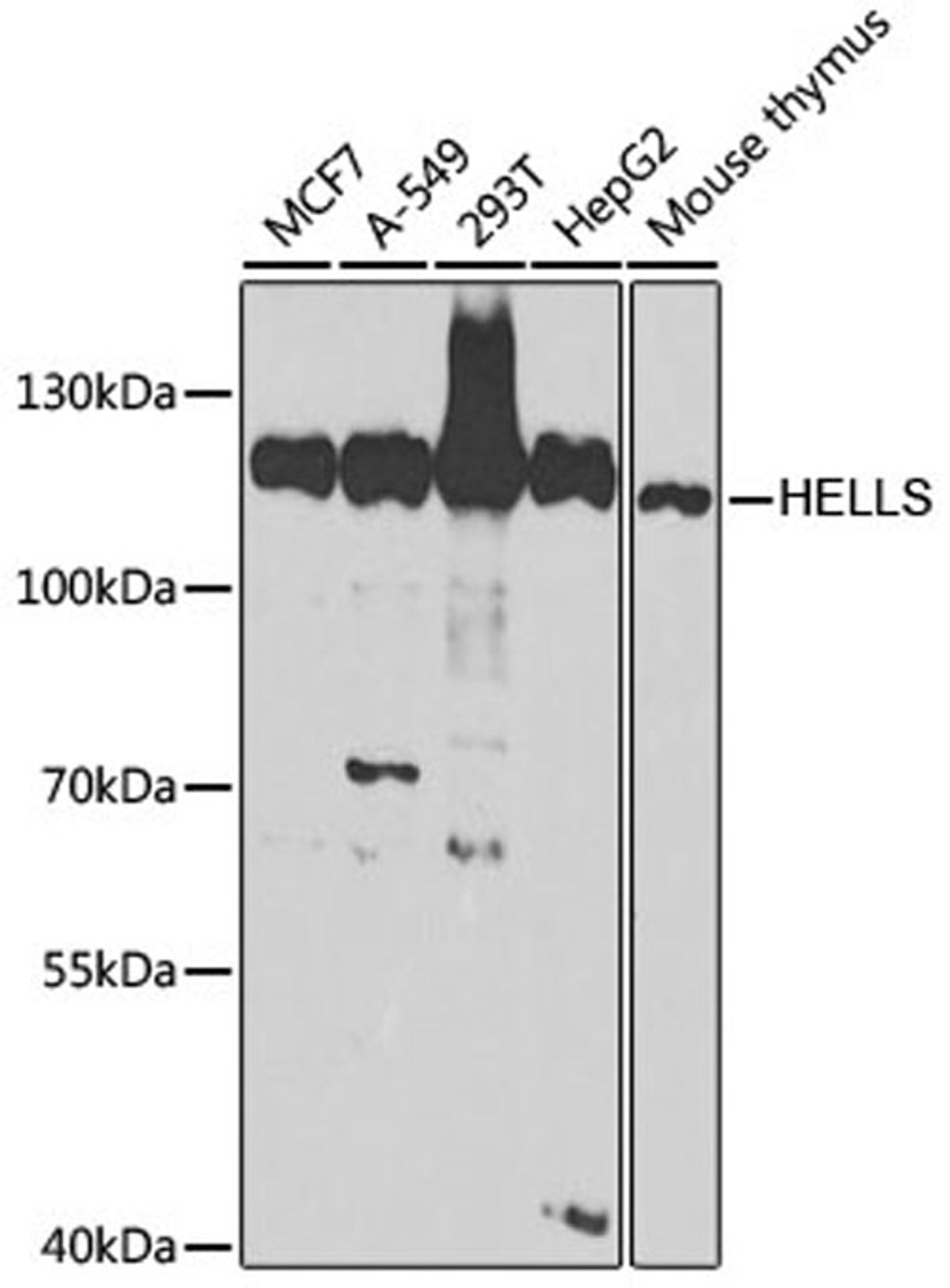 Western blot - HELLS antibody (A5831)