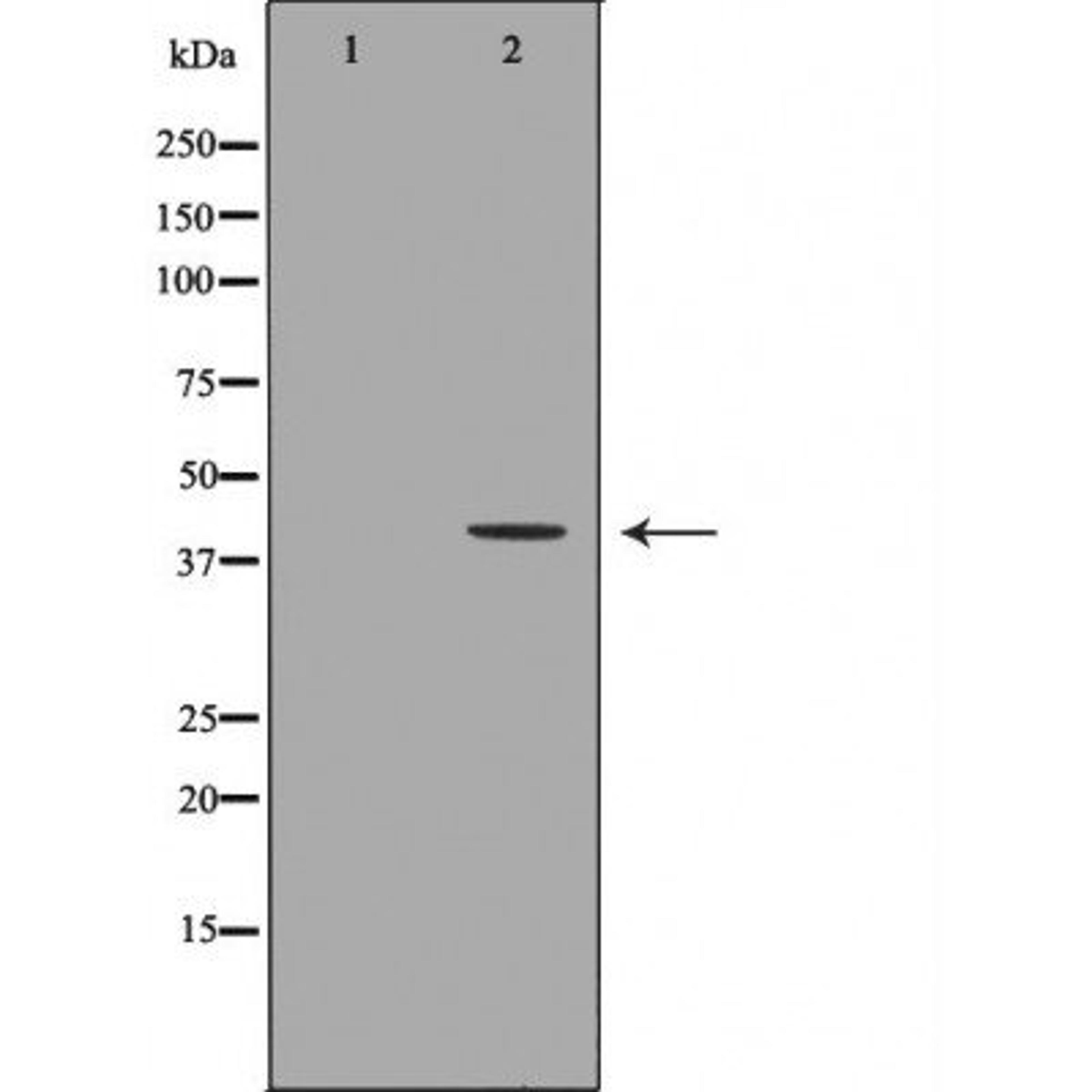 Western blot analysis of HepG2 cell lines using KIR2DL1 antibody