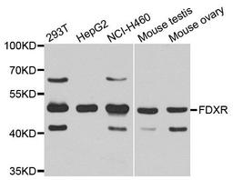 Western blot analysis of extracts of various cell lines using FDXR antibody