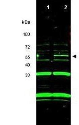 Western blot analysis of RKO cells using p47 ING3 antibody