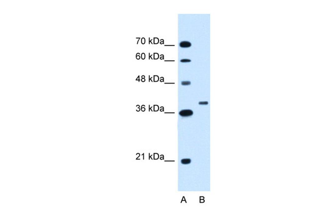 Antibody used in WB on Human HepG2 at 1.25 ug/ml.