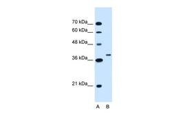 Antibody used in WB on Human HepG2 at 1.25 ug/ml.