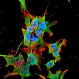 Immunofluorescence analysis of neuroblastoma cell line sk-n-be using TRAK2 antibody