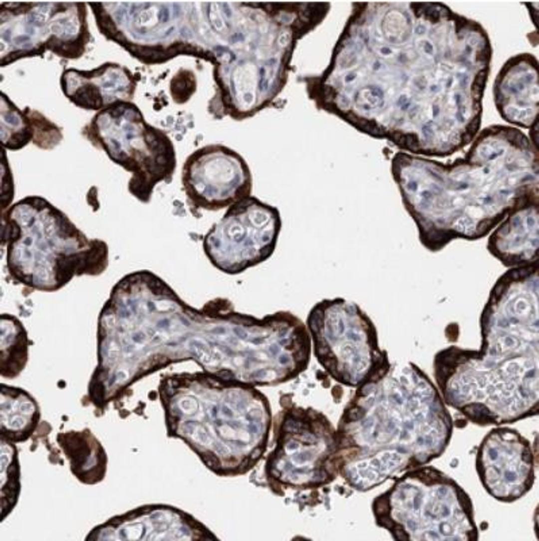 Immunohistochemistry: MORN3 Antibody [NBP2-30560] - Staining of human placenta shows strong cytoplasmic positivity in trophoblastic cells.