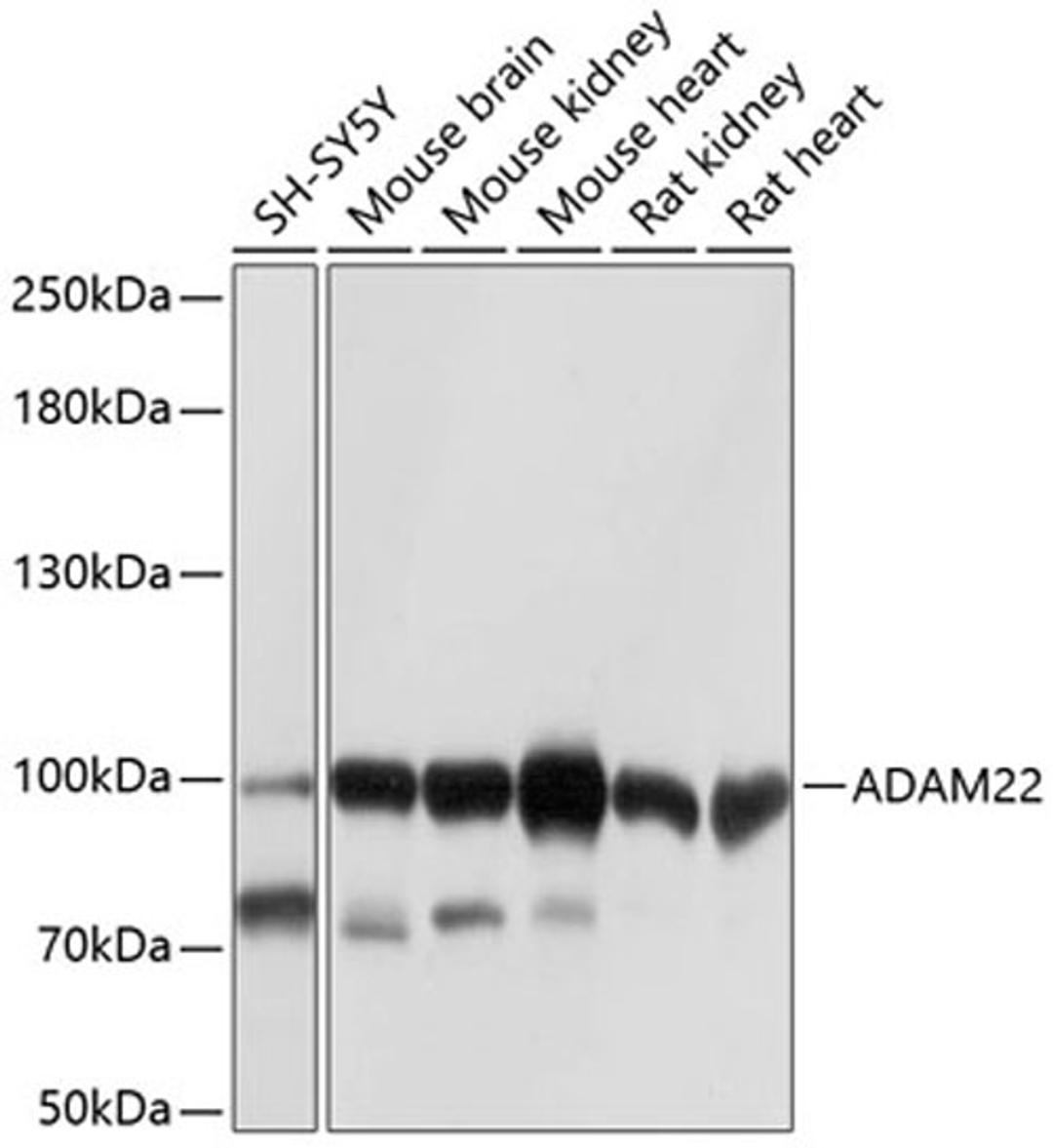 Western blot - ADAM22 antibody (A10030)