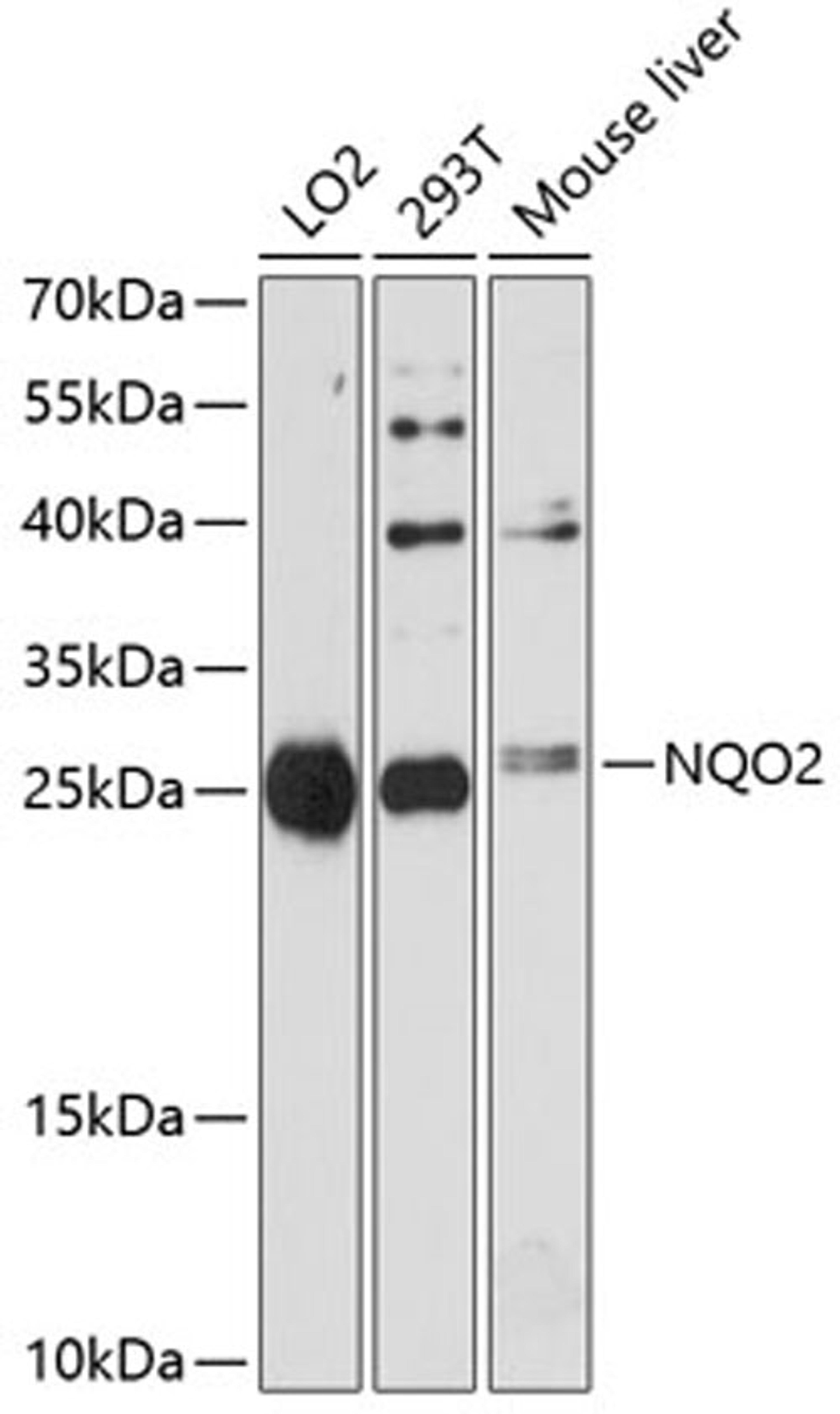 Western blot - NQO2 antibody (A11746)