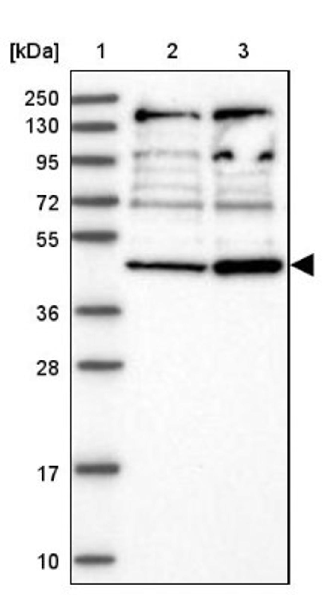 Western Blot: RNF44 Antibody [NBP1-82930] - Lane 1: Marker [kDa] 250, 130, 95, 72, 55, 36, 28, 17, 10<br/>Lane 2: Human cell line RT-4<br/>Lane 3: Human cell line U-251MG sp