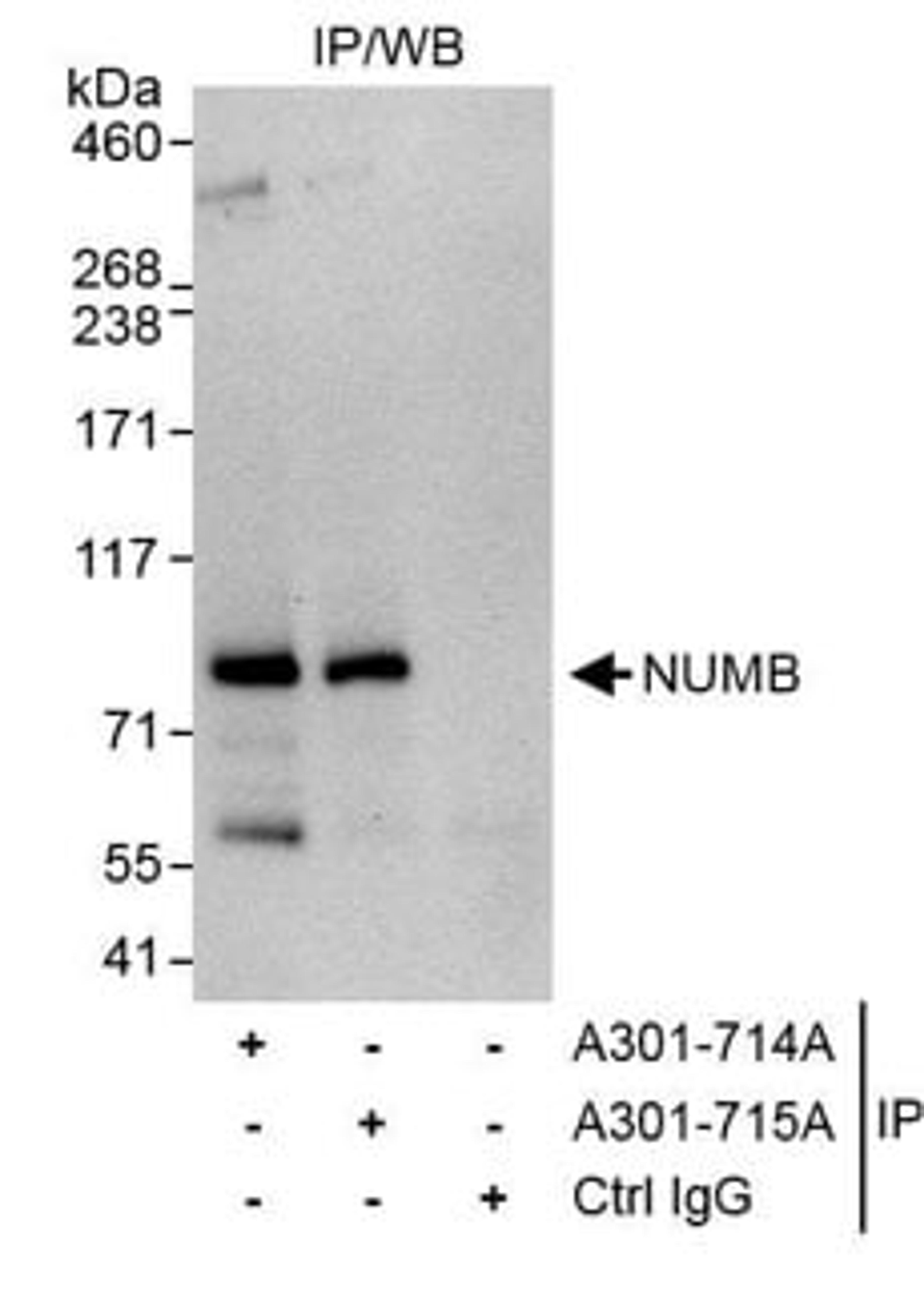 Detection of human NUMB by western blot of immunoprecipitates.