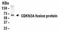 Western Blot detection of CDKN2A antibody.