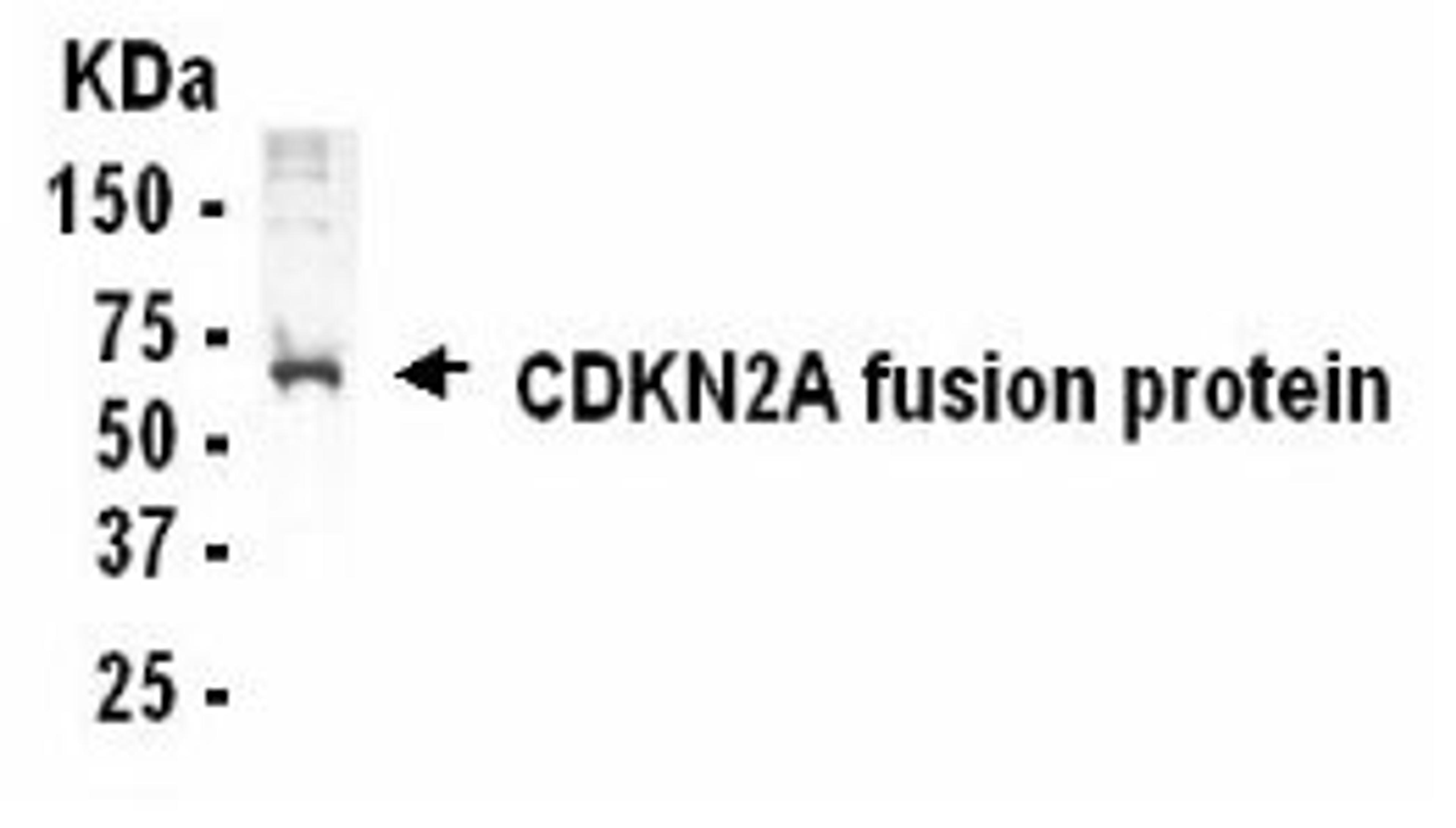 Western Blot detection of CDKN2A antibody.