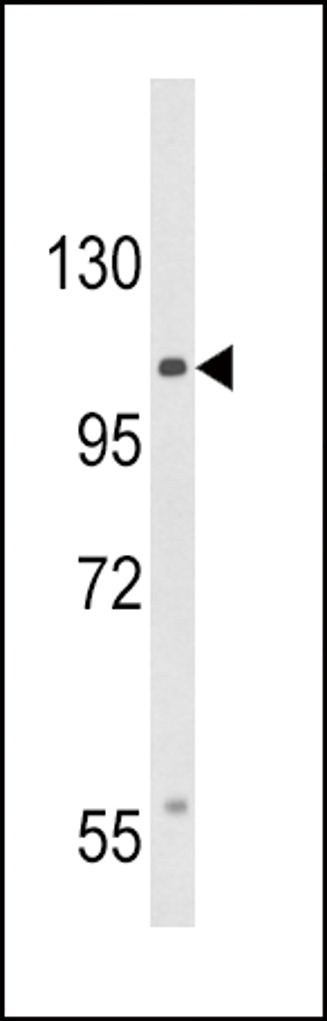 Western blot analysis of CACNA2D3 Antibody in HepG2 cell line lysates (35ug/lane)