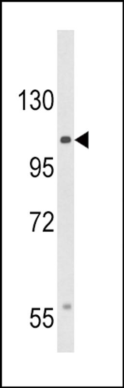 Western blot analysis of CACNA2D3 Antibody in HepG2 cell line lysates (35ug/lane)