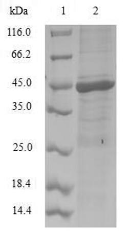 (Tris-Glycine gel) Discontinuous SDS-PAGE (reduced) with 5% enrichment gel and 15% separation gel.