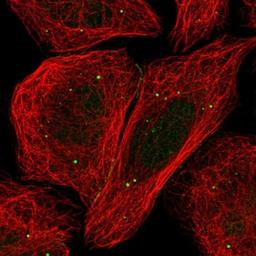 Immunocytochemistry/Immunofluorescence: SNRK Antibody [NBP1-83668] - Staining of human cell line U-2 OS shows positivity in nucleus, vesicles & cell junctions.