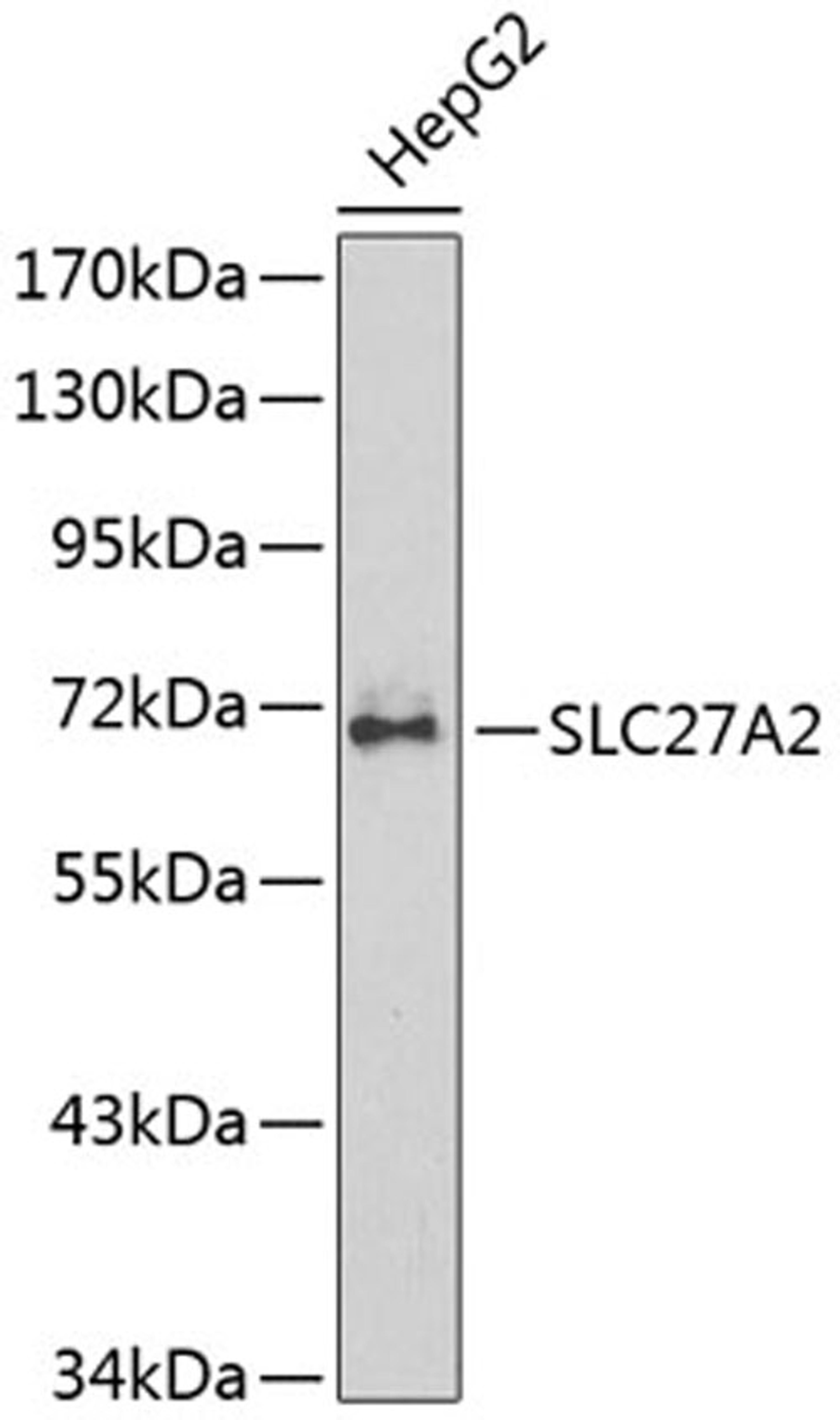 Western blot - SLC27A2 antibody (A1077)