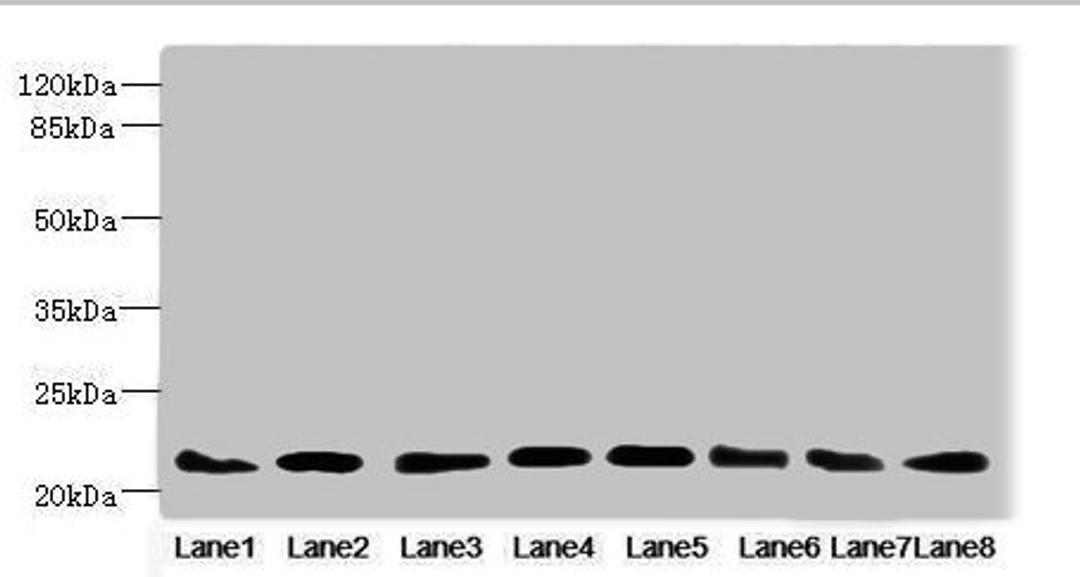 Western blot. All lanes: RAB23 antibody at 3.88ug/ml. Lane 1: Mouse ocular tissue. Lane 2: Rat brain tissue. Lane 3: Mouse kidney tissue. Lane 4: Mouse lung tissue. Lane 5: Mouse brain tissue. Lane 6: NIH/3T3 whole cell lysate. Lane 7: MCF-7 whole cell lysate. Lane 8: Hela whole cell lysate. Secondary. Goat polyclonal to rabbit IgG at 1/10000 dilution. Predicted band size: 27 kDa. Observed band size: 27 kDa.