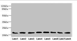 Western blot. All lanes: RAB23 antibody at 3.88ug/ml. Lane 1: Mouse ocular tissue. Lane 2: Rat brain tissue. Lane 3: Mouse kidney tissue. Lane 4: Mouse lung tissue. Lane 5: Mouse brain tissue. Lane 6: NIH/3T3 whole cell lysate. Lane 7: MCF-7 whole cell lysate. Lane 8: Hela whole cell lysate. Secondary. Goat polyclonal to rabbit IgG at 1/10000 dilution. Predicted band size: 27 kDa. Observed band size: 27 kDa.