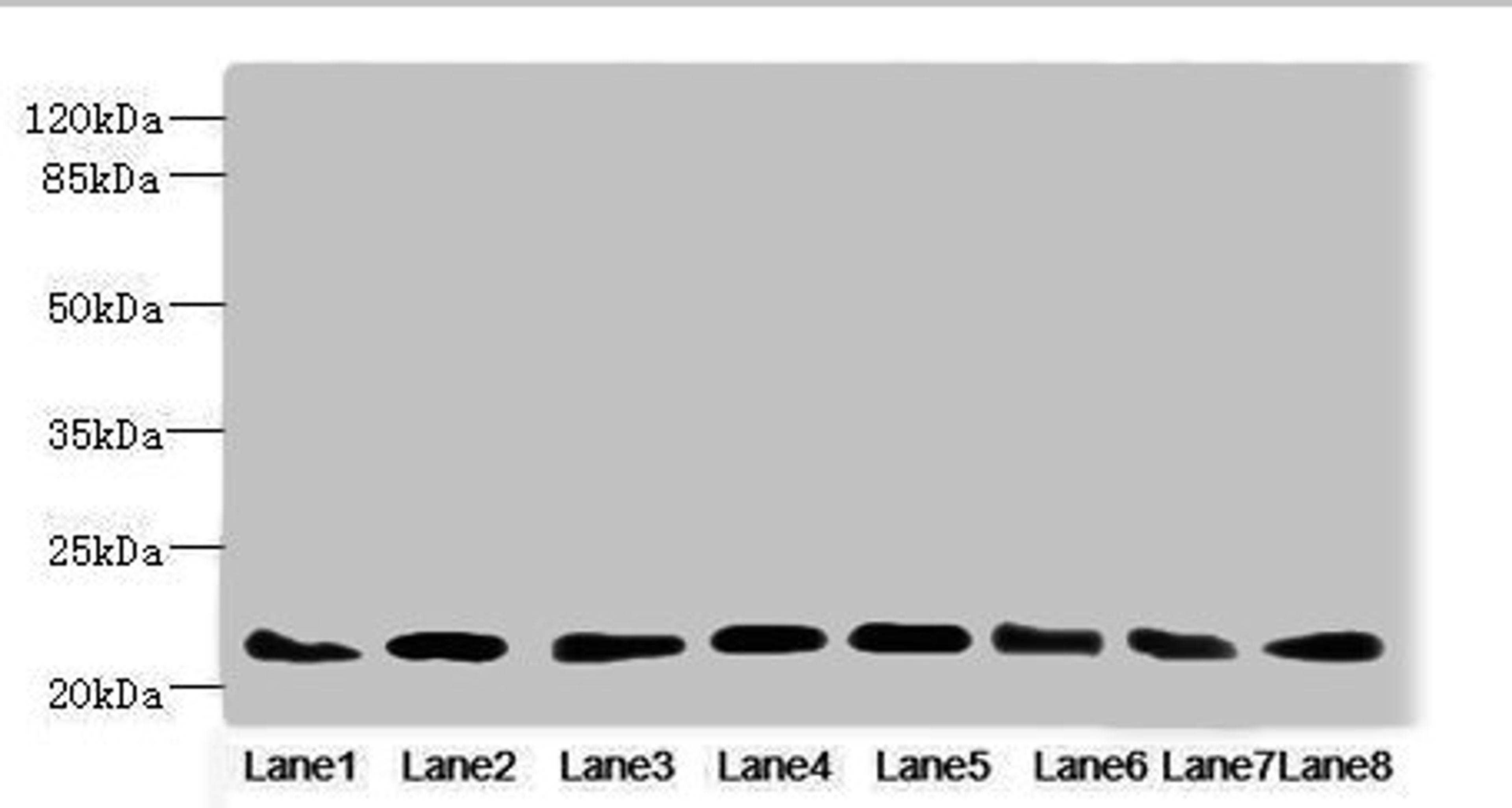Western blot. All lanes: RAB23 antibody at 3.88ug/ml. Lane 1: Mouse ocular tissue. Lane 2: Rat brain tissue. Lane 3: Mouse kidney tissue. Lane 4: Mouse lung tissue. Lane 5: Mouse brain tissue. Lane 6: NIH/3T3 whole cell lysate. Lane 7: MCF-7 whole cell lysate. Lane 8: Hela whole cell lysate. Secondary. Goat polyclonal to rabbit IgG at 1/10000 dilution. Predicted band size: 27 kDa. Observed band size: 27 kDa.
