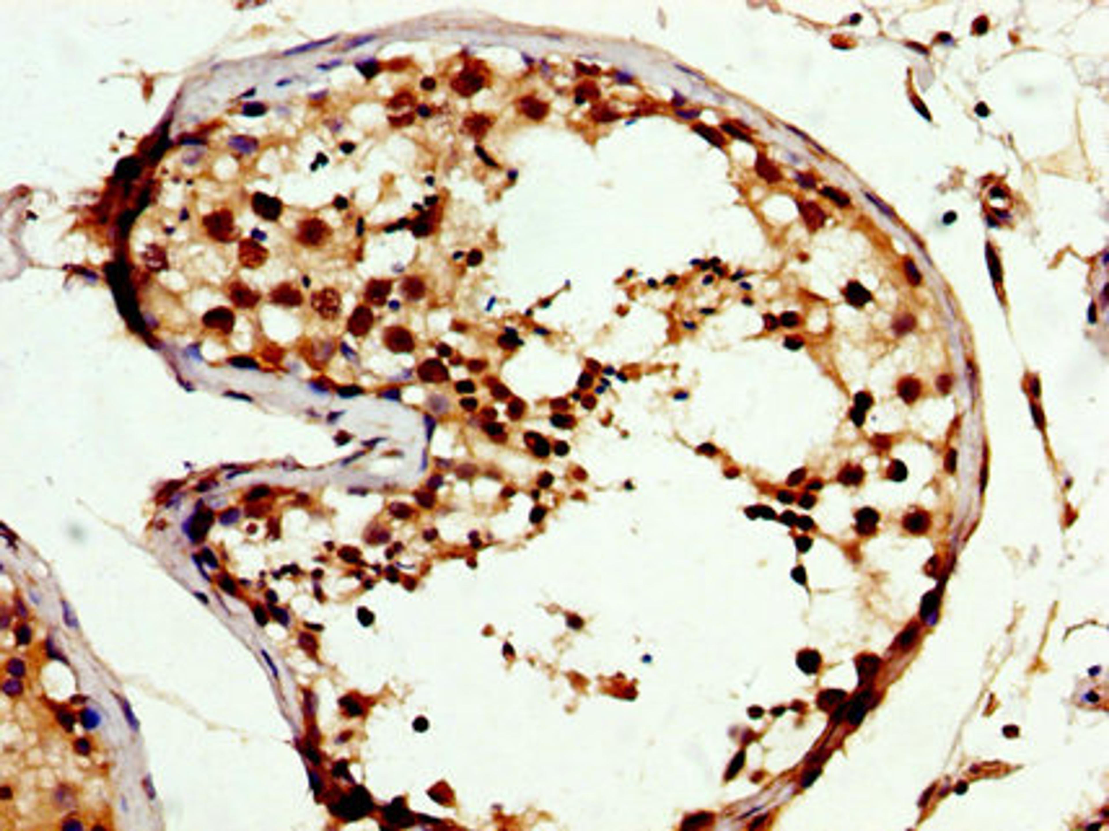 IHC image of CSB-PA005961LA01HU diluted at 1:300 and staining in paraffin-embedded human testis tissue performed on a Leica BondTM system. After dewaxing and hydration, antigen retrieval was mediated by high pressure in a citrate buffer (pH 6.0). Section was blocked with 10% normal goat serum 30min at RT. Then primary antibody (1% BSA) was incubated at 4&deg;C overnight. The primary is detected by a biotinylated secondary antibody and visualized using an HRP conjugated SP system.