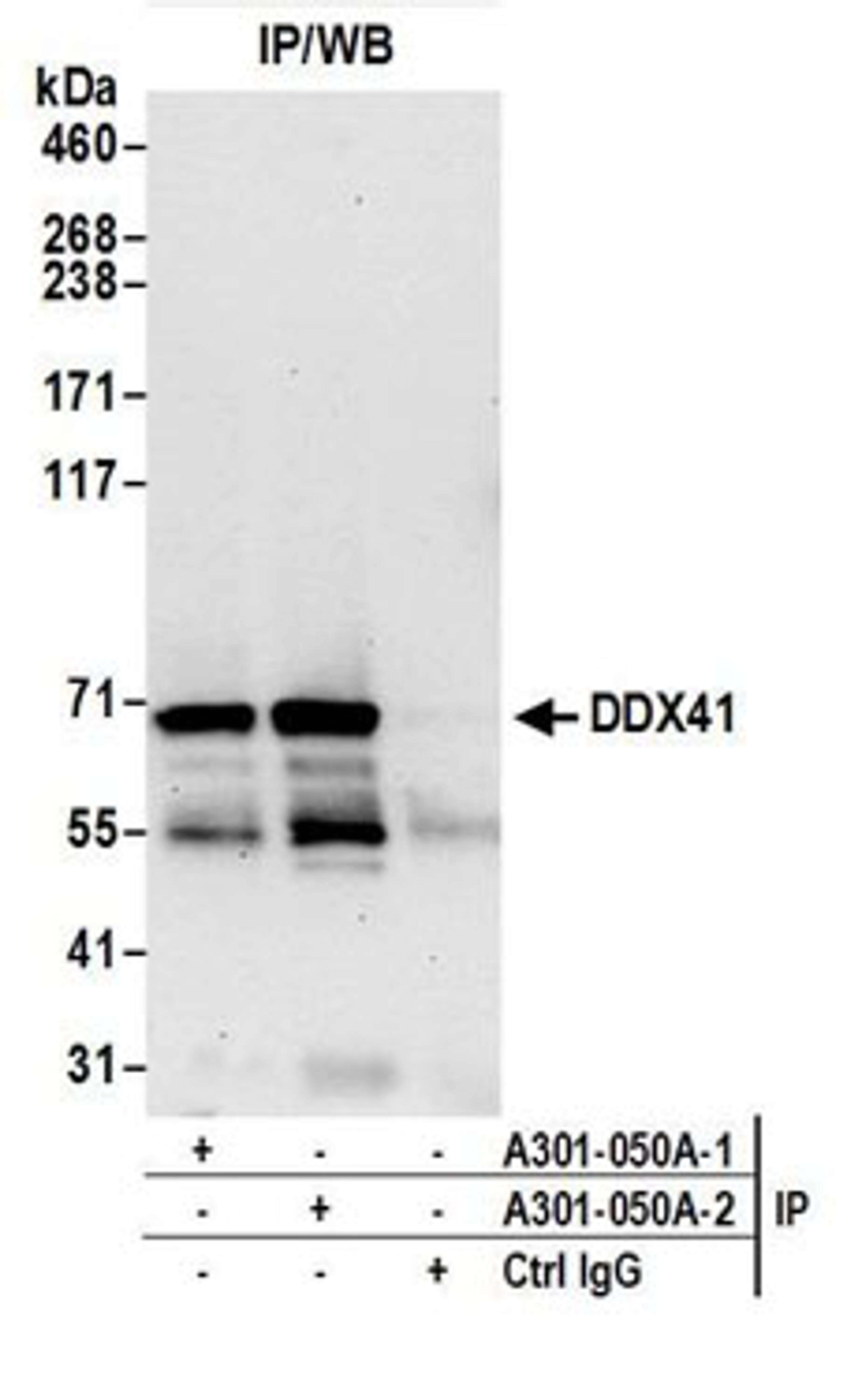 Detection of human DDX41 by western blot of immunoprecipitates.