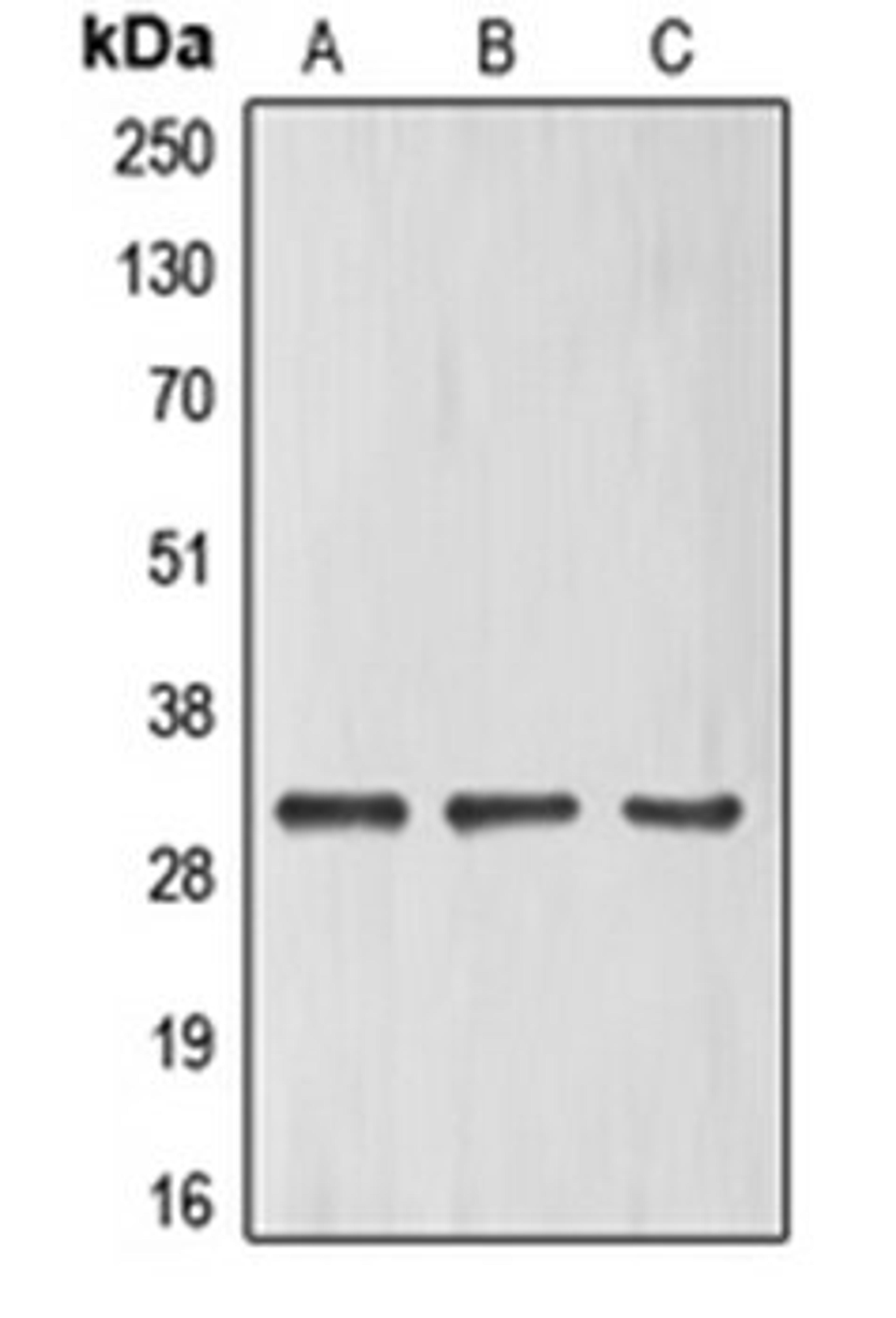 Western blot analysis of HeLa (Lane 1), HuvEc (Lane 2), Jurkat (Lane 3) whole cell lysates using ELF5 antibody