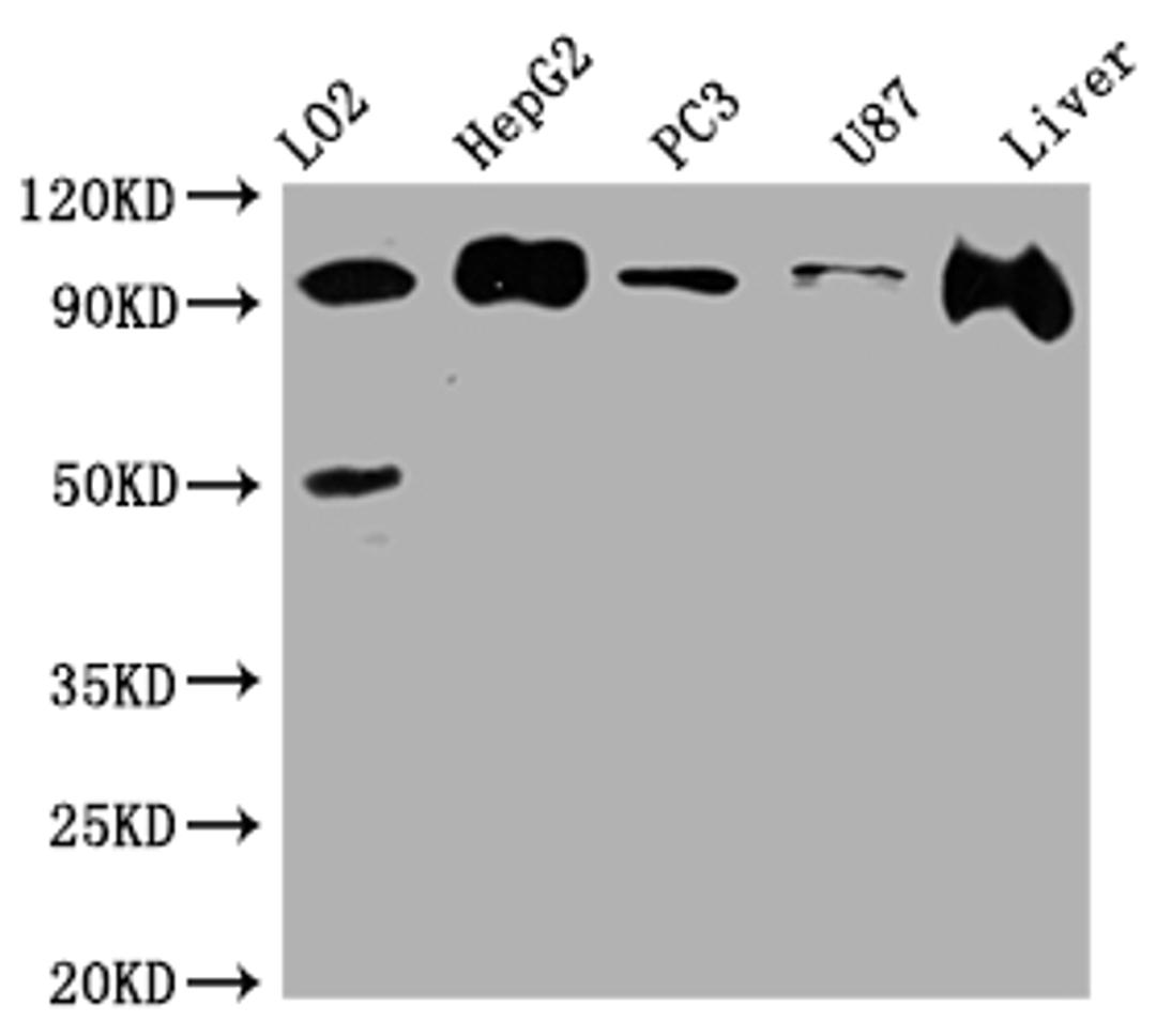 Western Blot. Positive WB detected in: L02 whole cell lysate, HepG2 whole cell lysate, PC-3 whole cell lysate, U-87 whole cell lysate, Rat Liver whole cell lysate. All lanes: ALIX antibody at 1:1000. Secondary. Goat polyclonal to rabbit IgG at 1/50000 dilution. Predicted band size: 97, 97, 31 kDa. Observed band size: 97 kDa. 